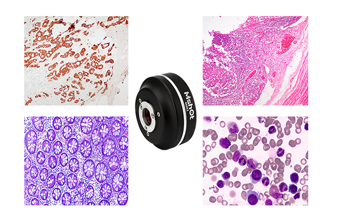 Cámaras de Microscopía M-Shot