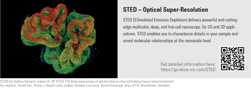 Sistema Confocal Leica Stellaris STED