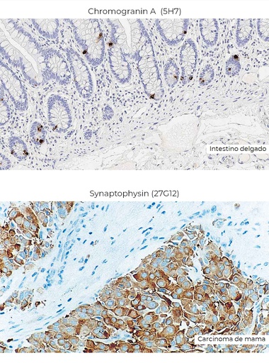 Patología de Cabeza, Cuello y Endocrino